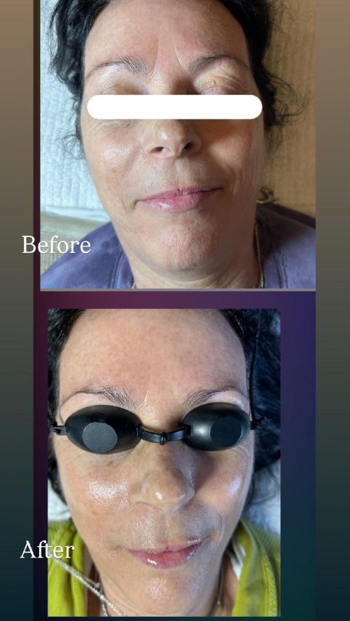 Before and After 2