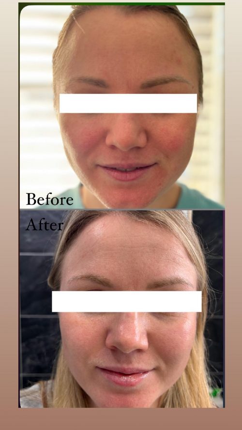 Before and After 3
