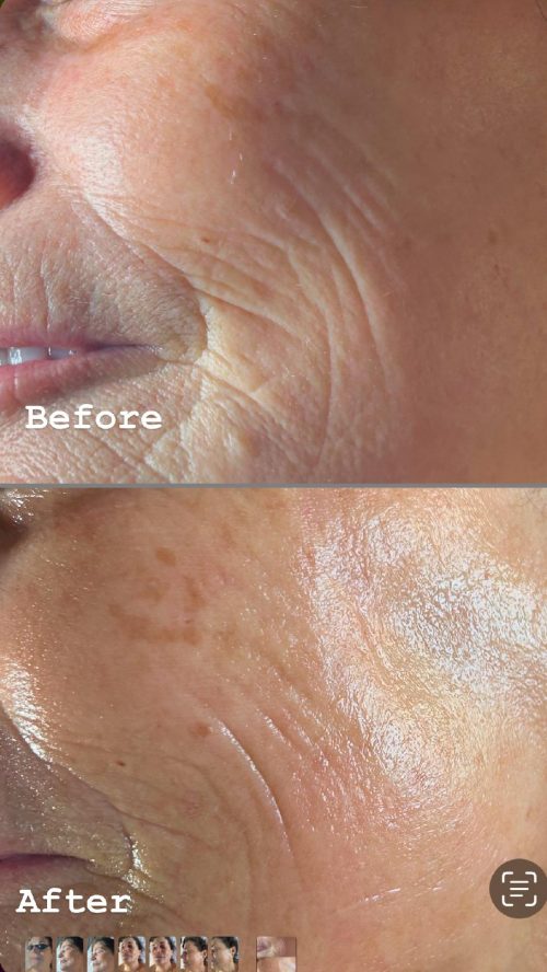 Before and After 6